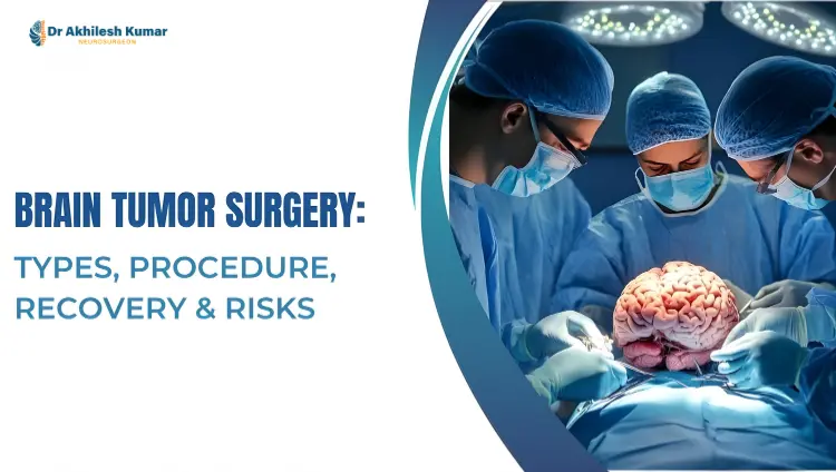 Three surgeons performing brain tumor surgery in an operating room, with a visible brain model and the title “Brain Tumor Surgery: Types, Procedure, Recovery & Risks” displayed on the left side.
