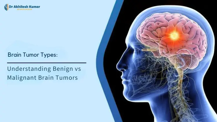 Illustration of human brain highlighting a tumor with the title “Brain Tumor Types: Understanding Benign vs Malignant Brain Tumors” and branding of Dr. Akhilesh Kumar.