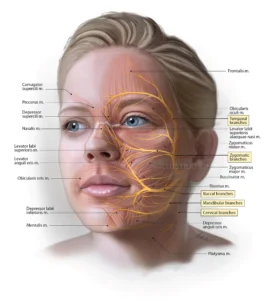 Facial Nerve Treatment Lucknow